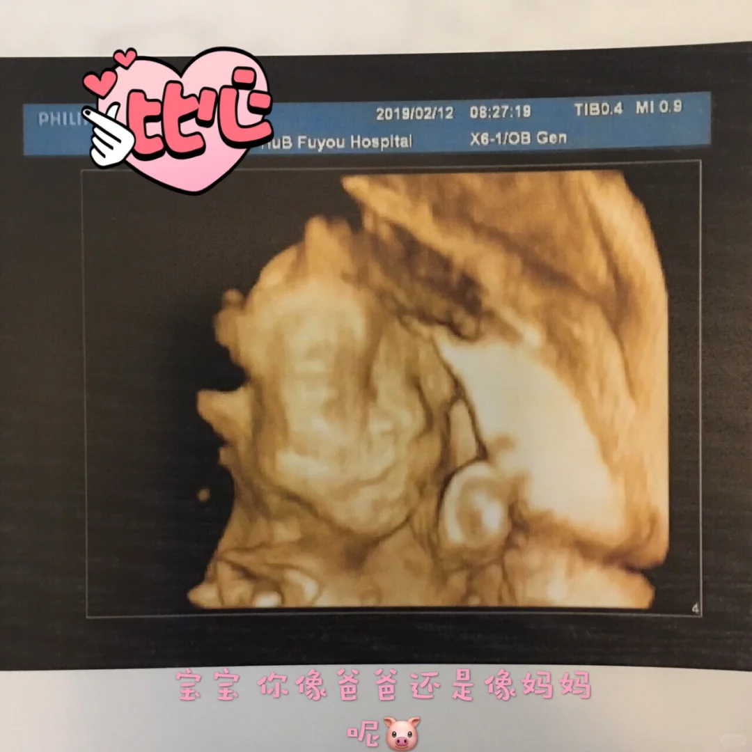 🌈湖北省妇幼孕期产检全过程🤰孕期干货❗️ 孕期想吃肉