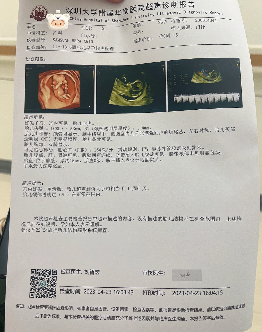 孕期产检 ｜ NT一次过～ 孕期梦见绳