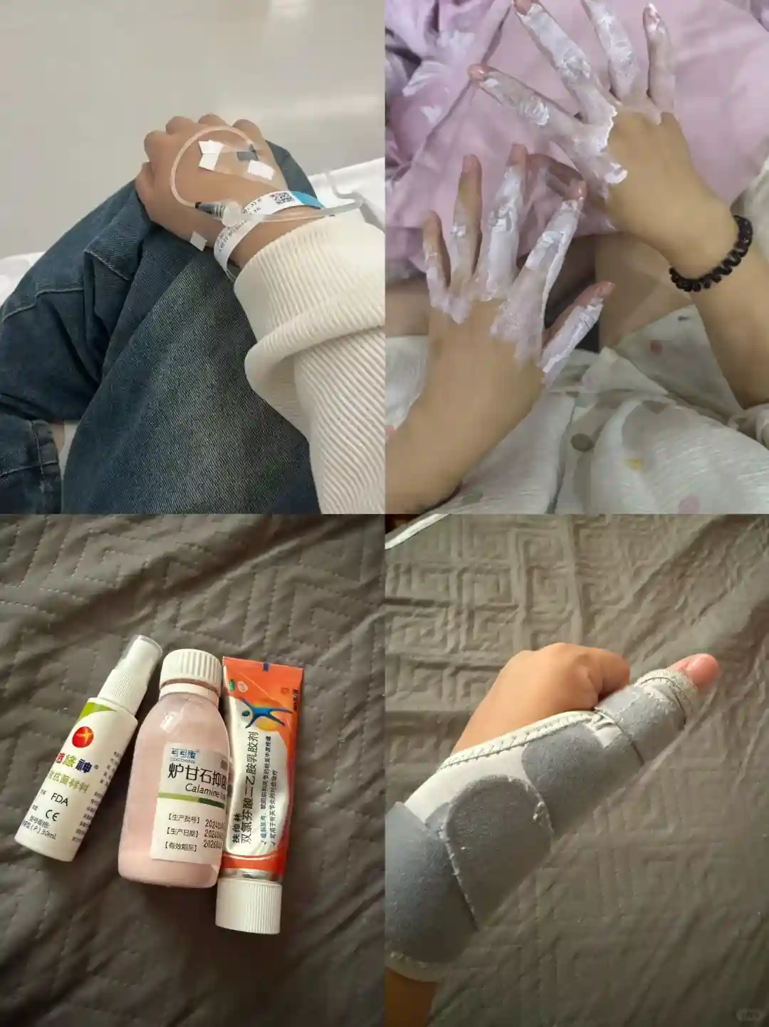 孕期可能出现的不适症状及处理方法 怀孕期间拍片