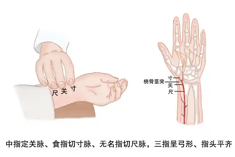 怀孕的脉象 孕期高血压怎么办最好