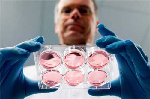 试管胚胎移植前后的注意事项！附提高试管婴儿成功率的方法