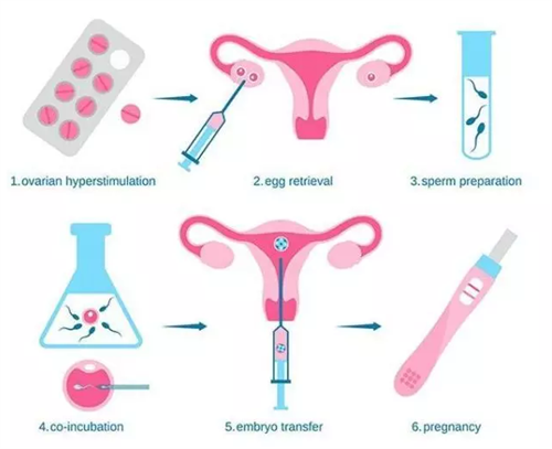 供精三代试管全面解析：2025年生育技术的实用指南