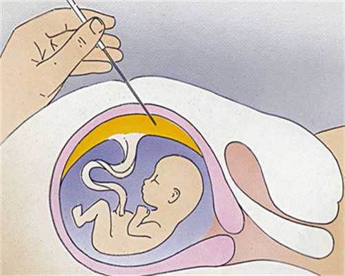 郑州三代试管技术：高效助孕的可靠路径