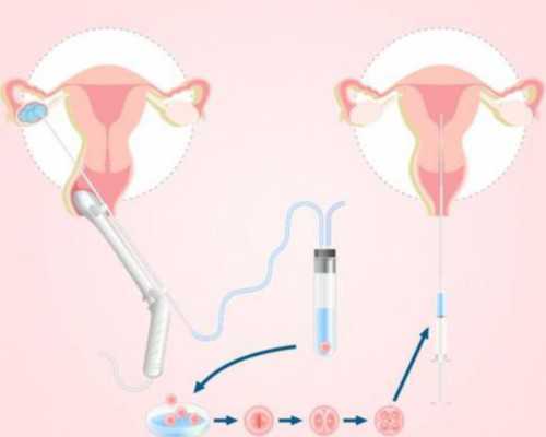 重庆三代试管婴：深入解析费用与医院选择