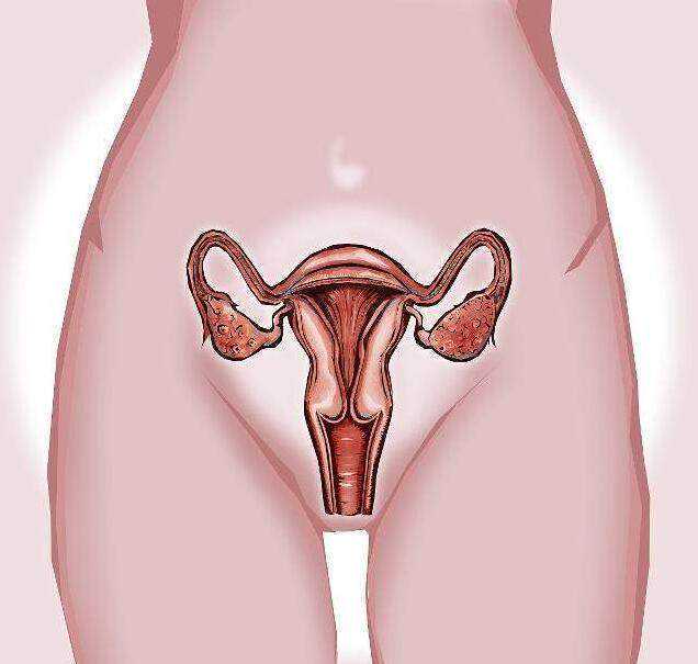 女性经期过长当心患病 月经期能喝骆驼奶粉吗女生