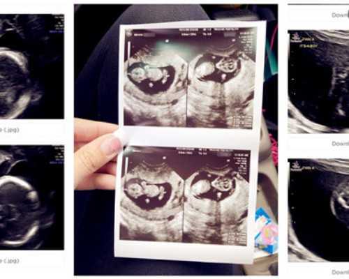 广东省供卵试管费用全解析：家庭预算与医疗成本指南