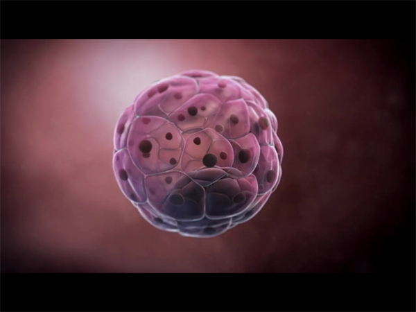 试管取卵后怎么判断腹水严重程度？取卵后腹水的症状有哪些