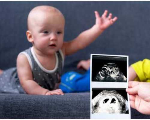 南宁三代试管包成功，真能保证生男孩吗？